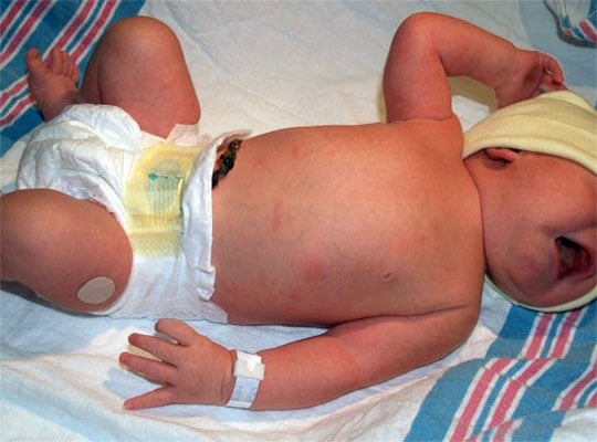 Healthy Mothers and Babies Grant to reduce Neonatal Opioid Withdrawal Syndrome awarded to Arizona Youth Partnership