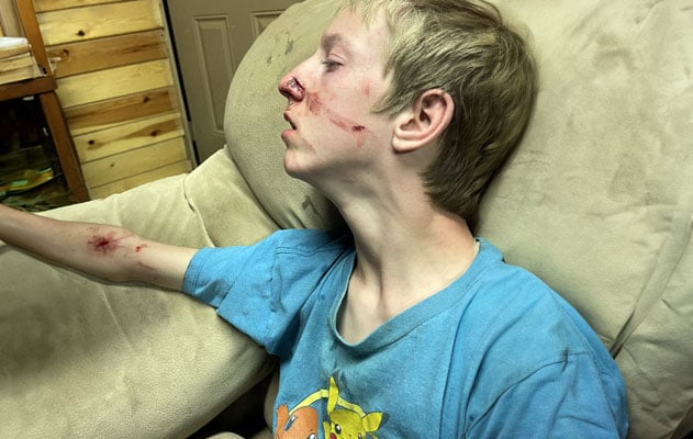 Black bear attacks Pima youth camping in Alpine