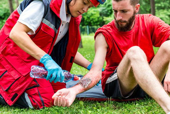 Why Are Burn Injuries Often Underestimated in Personal Injury Lawsuits?